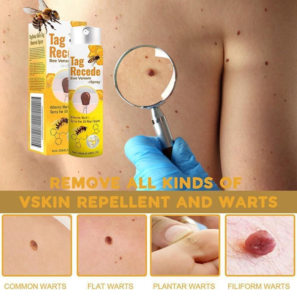 Image-OMINS:91579