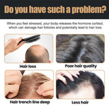 Image-OMINS:98291