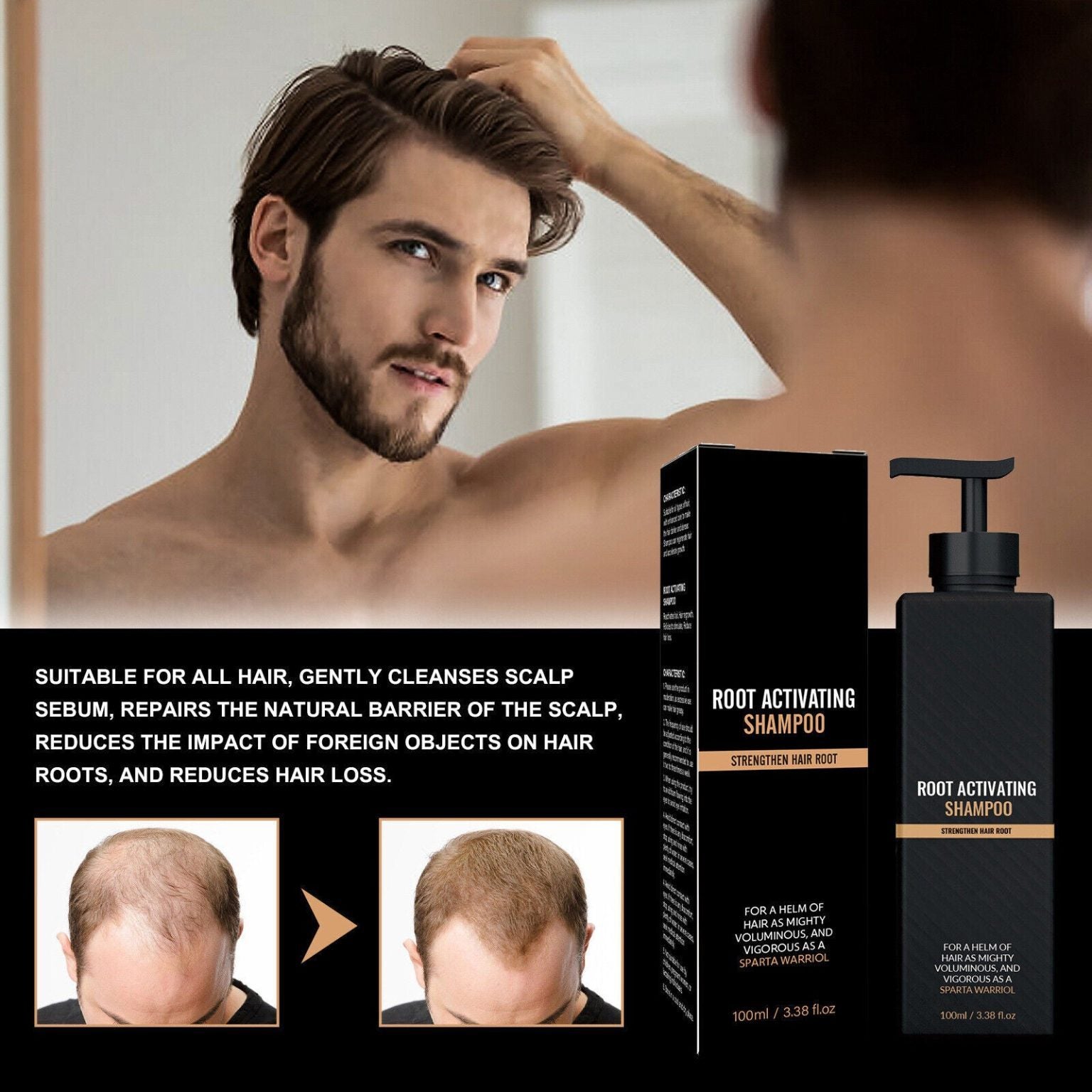 Image-OMINS:98304