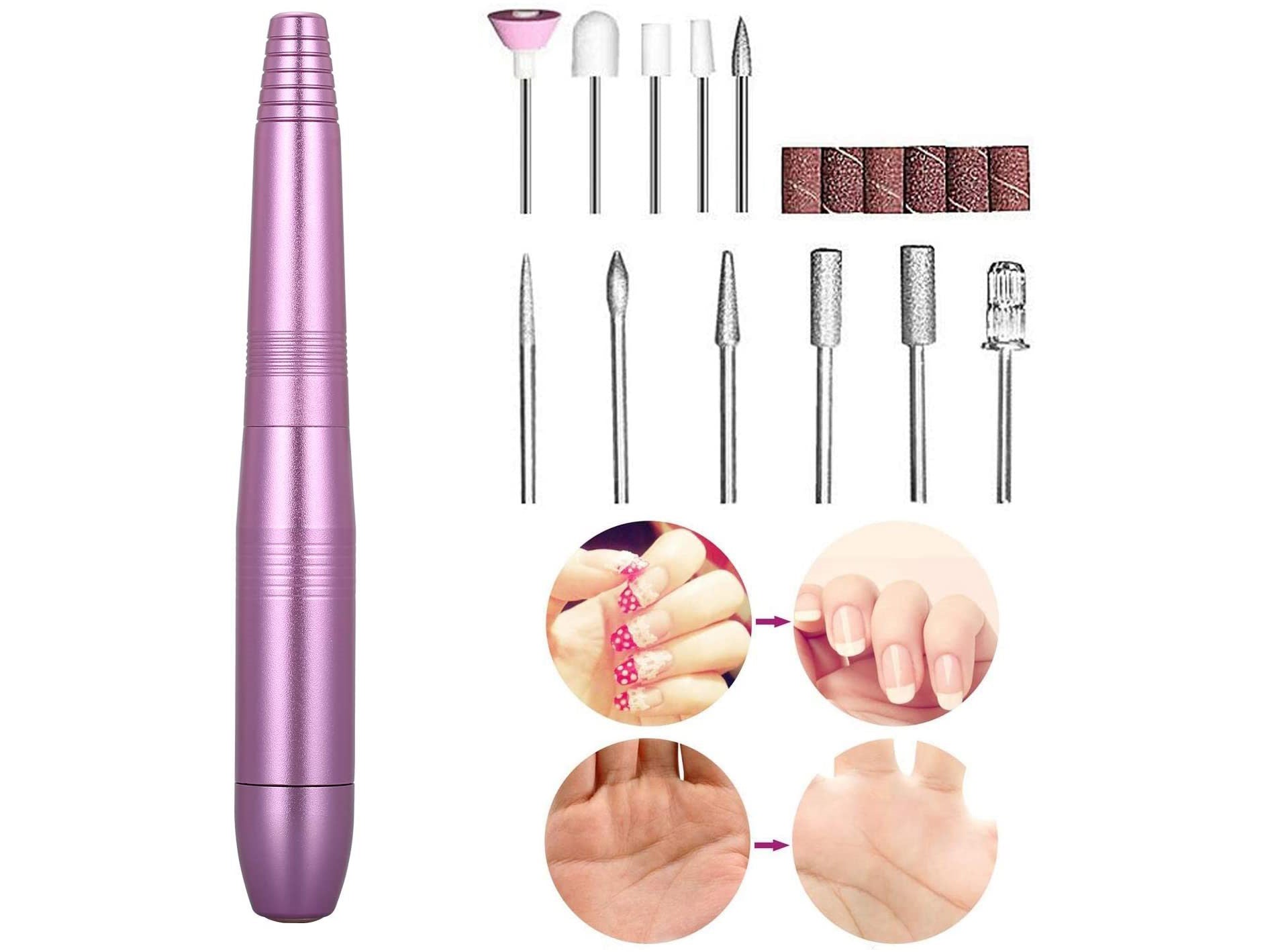 Image-OMINS:43231